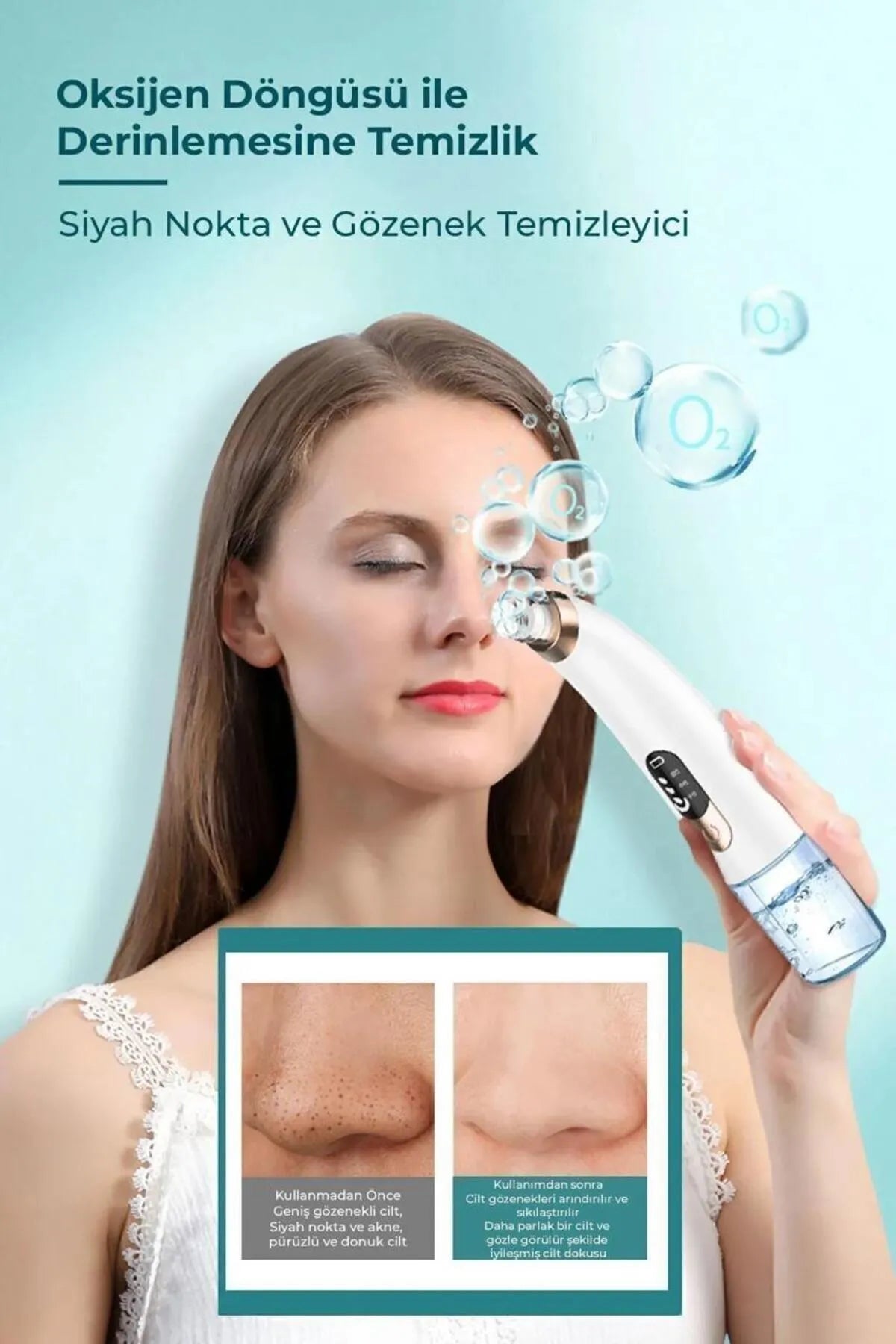 Vakumlu Siyah Nokta Temizleyicisi Beauty World