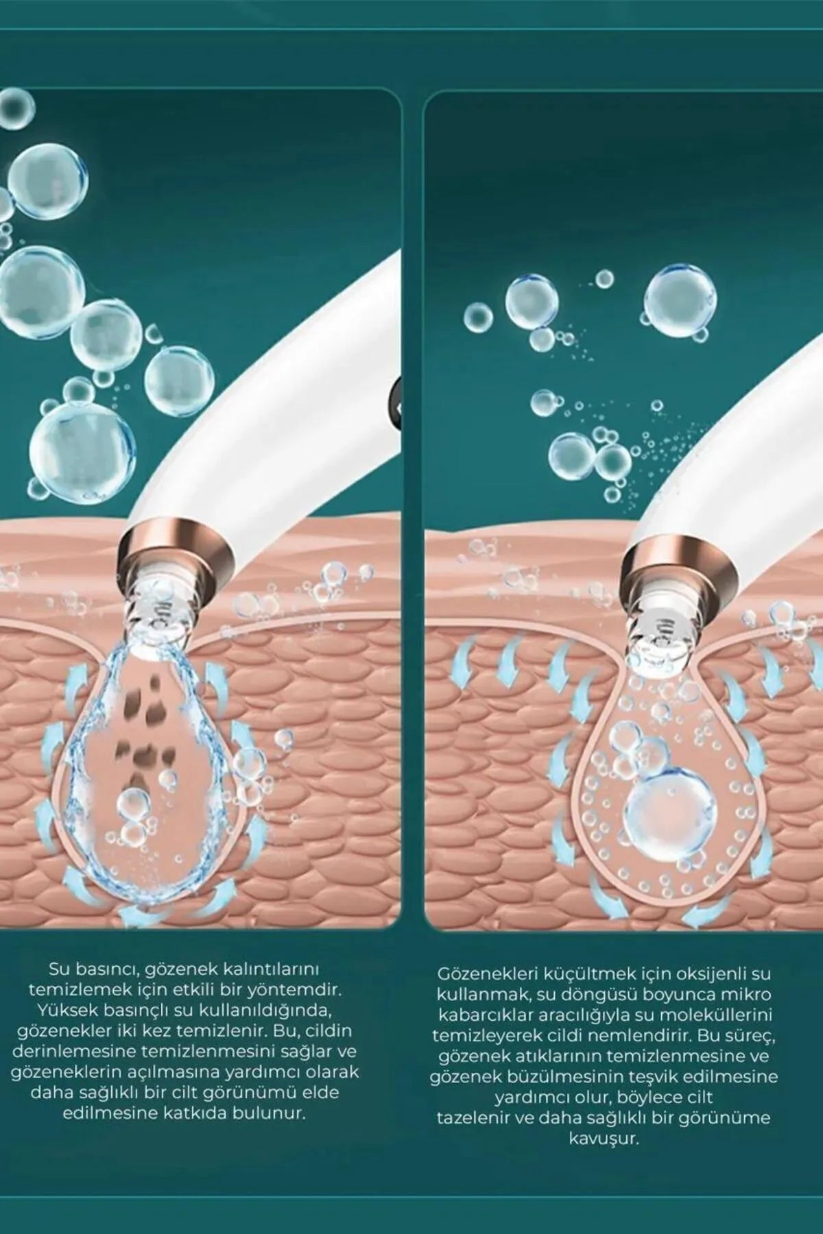 Vakumlu Siyah Nokta Temizleyicisi Beauty World